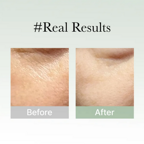 Load image 1 in gallery view. ARENCIA Holy Hyssop Serum 30