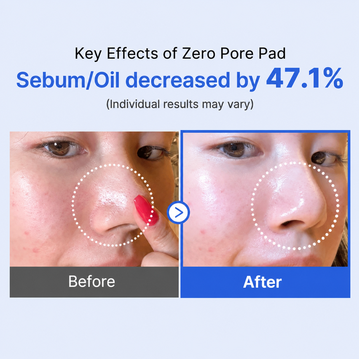MEDICUBE Zero Pore Pad 2.0