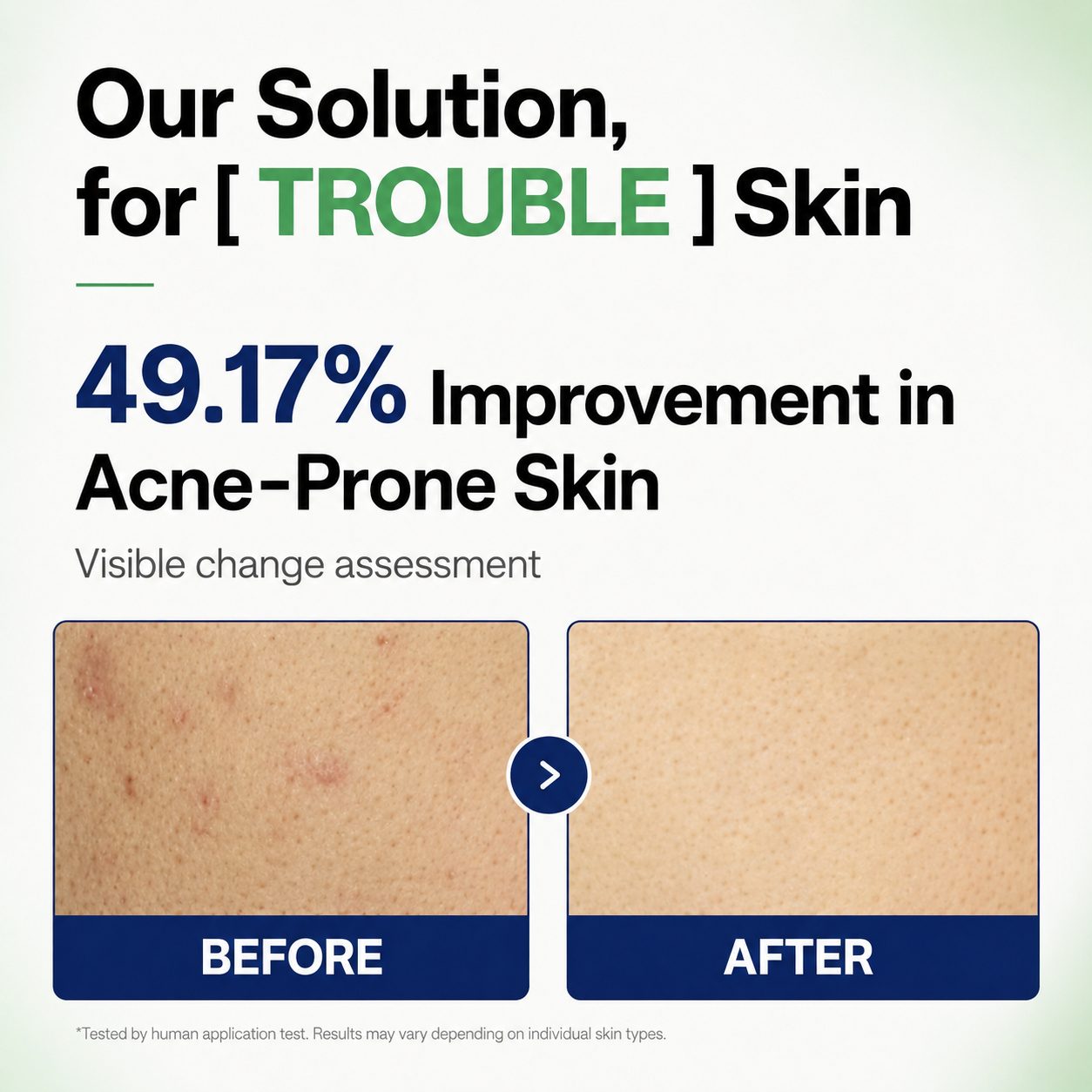 MEDIHEAL Teatree Trouble Pad