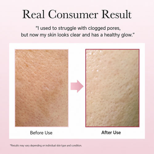 Load image 1 in gallery view. ARENCIA Fresh Rosehip Rice Mochi Cleanser