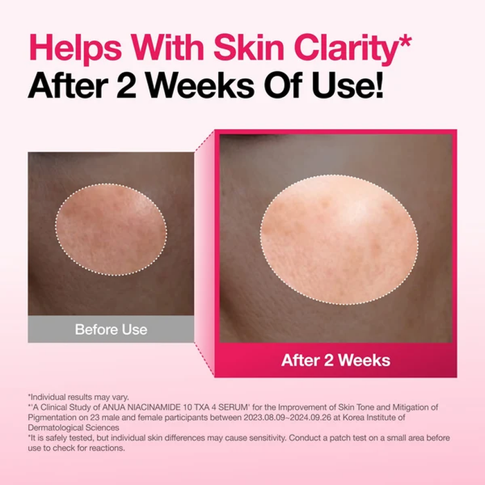 ANUA Niacinamide 10% + TXA 4% Serum