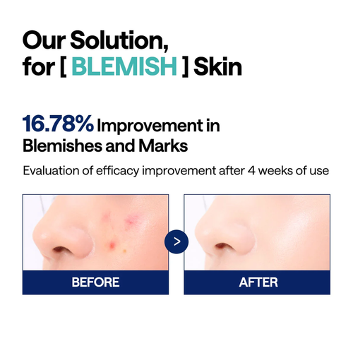 Load image 1 in gallery view. MEDIHEAL Madecassoside Blemish Pad 100 Pads