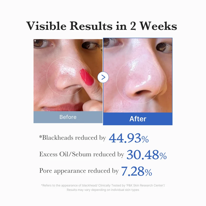 MEDICUBE Zero Pore Pad 2.0