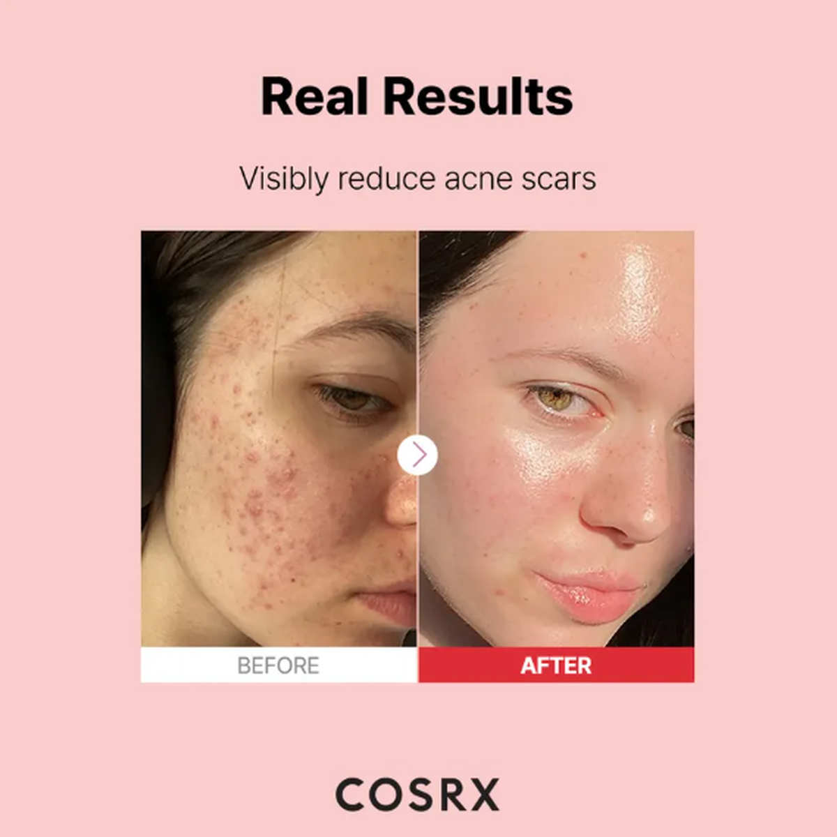 COSRX The Niacinamide 15 Serum 20ml
