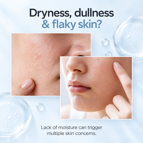 Load image 1 in gallery view. ANUA Birch Moisture Boosting Serum