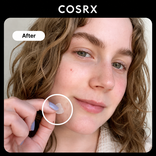 Load image 1 in gallery view. COSRX Acne Pimple Master Patch
