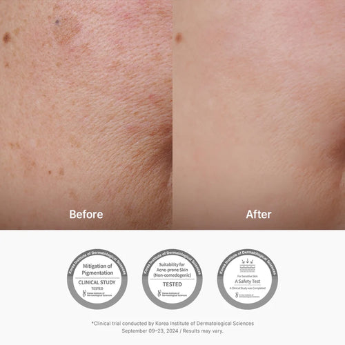 Load image 1 in gallery view. DR.ALTHEA Vitamin C Boosting Serum 30ml